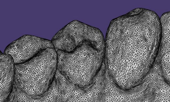 Dentaltechnik - UK Zähne Mesh4