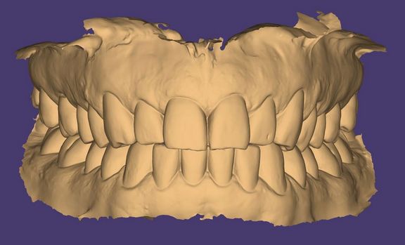 Zähne - Digitale Dentaltechnik